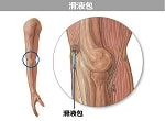 滑液包図