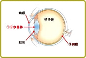 眼球図